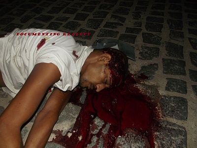 bleeding-20on-20sidewalk-20-282-29.jpg