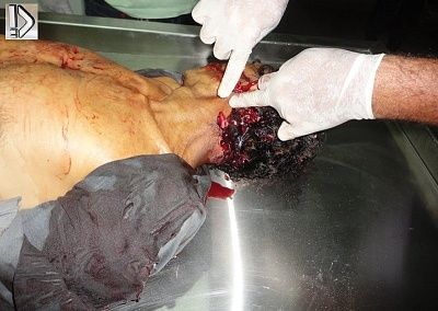 stabbed-20man-20-282-29.jpg