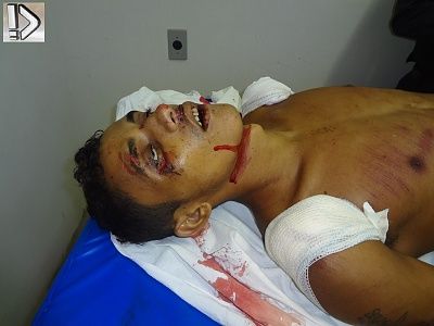 stabbed-20male-20-281-29.jpg