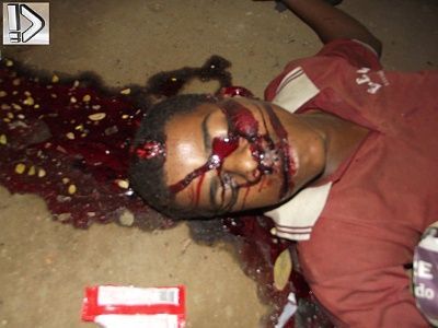 shot-20forehead-20-284-29.jpg