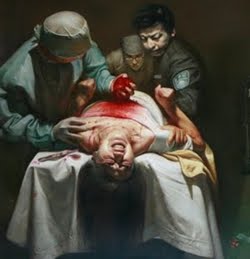 organharvesting-1-.jpg