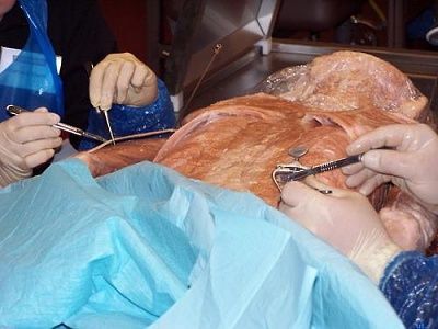 20human-20body-20being-20worked-20on-20at-20von-20hagens-e2-80-99-20plastinarium-20in-20guben-.jpg