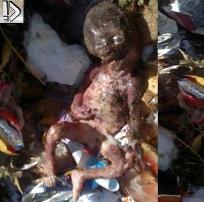 fetus-20-281-29.jpg