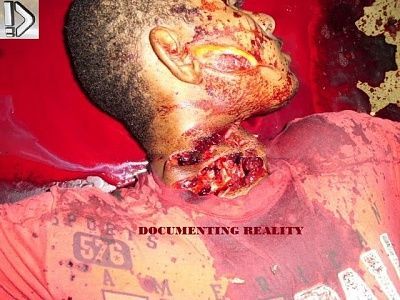 machete-20hacked-20neck-20-281-29.jpg