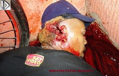 shotgun-20blast-20to-20head-20-281-29.jpg