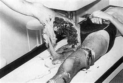 shark_attack_pictures_01.jpg
