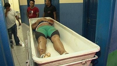 39-20yo-20woman-20arriving-20at-20morgue-2003.jpg
