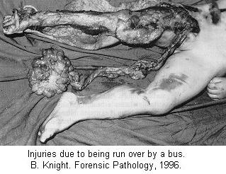 ran-over-bus.jpg
