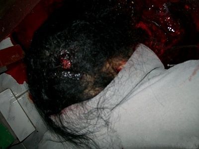 31-20yo-20woman-20shot-20in-20her-20home-2005.jpg