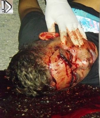 motorcyclist-20dead-20in-20street-20-281-29.jpg