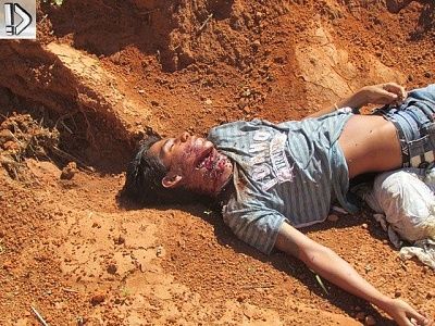 machete-20hacked-20young-20man-20-285-29.jpg