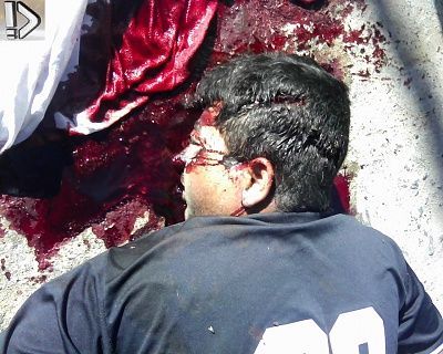 bleeding-20guy-20-281-29.jpg