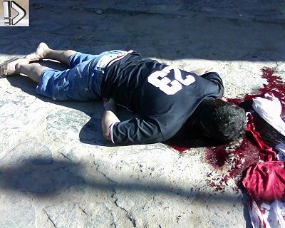 bleeding-20guy-20-283-29.jpg