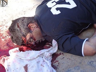 bleeding-20guy-20-287-29.jpg