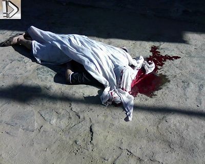 bleeding-20guy-20-2810-29.jpg