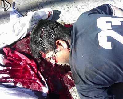 bleeding-20guy-20-2812-29.jpg