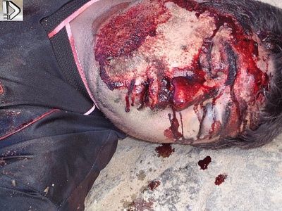 bleeding-20guy-20-289-29.jpg