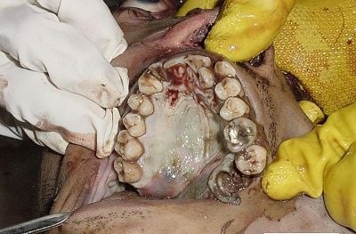 dead-20mans-20teeth.jpg