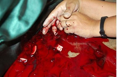 41-20yo-20woman-20killed-20by-20her-20brother-2003.jpg