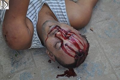 bleeding-20on-20the-20pavement-20june-202013-20-284-29.jpg
