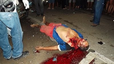 chunk-20ripped-20out-20of-20shoulder-20-281-29.jpg