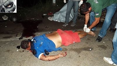 chunk-20ripped-20out-20of-20shoulder-20-282-29.jpg