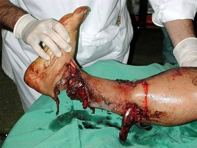 accidents-20-2819-29.jpg
