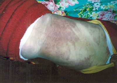 95.jpg