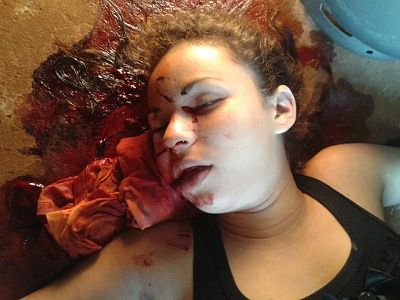 young-20woman-20shot-20in-20mouth-2001.jpg