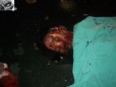 brutal-20head-20injury-20road-20acc-20-281-29.jpg