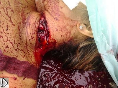 throat-20slit-20-281-29.jpg
