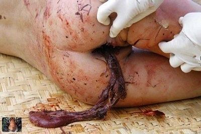 dead-20naked-20female-20-282-29.jpg