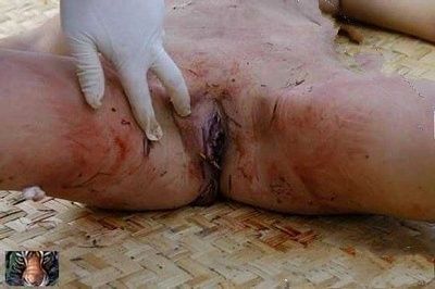 dead-20naked-20female-20-287-29.jpg
