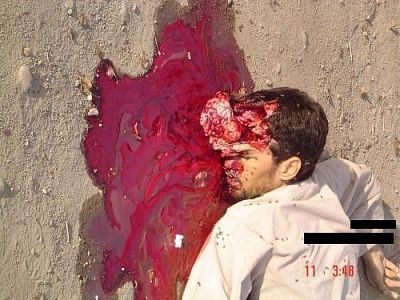 gunshot-wound-head-iraq-brain-500x375.jpg