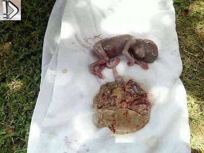fetus-20and-20placenta-20-281-29.jpg
