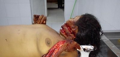 brutally-20hacked-20woman-2013th-20oct-20-281-29.jpg