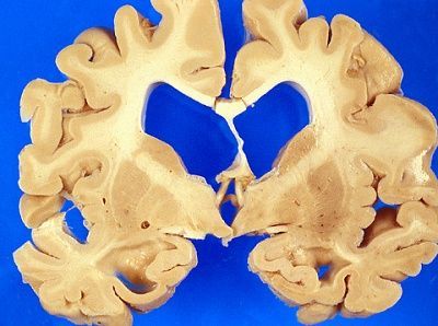 brains-20-282-29.jpg