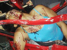 accidente_san_pedro_de_macoris.JPG