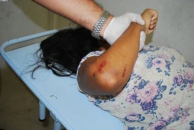 25-20yo-20woman-20died-20from-20electric-20shock-2003.jpg