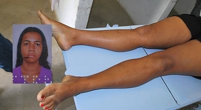 25-20yo-20woman-20died-20from-20electric-20shock-2006.jpg