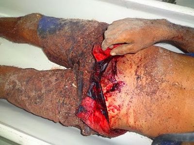 groin-20stabbed-2027th-20oct-20-281-29.jpg