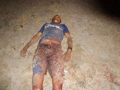 groin-20stabbed-2027th-20oct-20-283-29.jpg