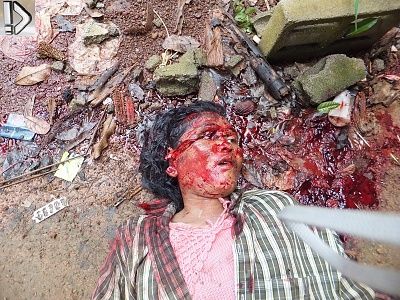head-20beaten-20in-2029th-20oct-20-281-29.jpg