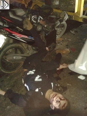 hand-20and-20knee-20torn-20-283-29.jpg