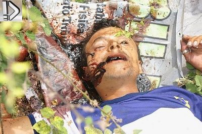 drug-20user-20killed-20-284-29.jpg