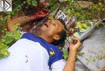 drug-20user-20killed-20-287-29.jpg