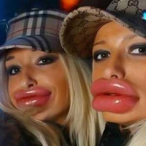 Biglips.jpg