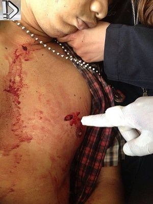 girlfriend-20holds-20stabbed-20bf-20-287-29.jpg