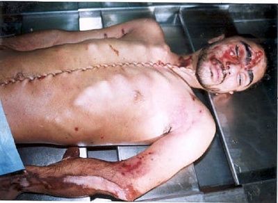 suture01a.jpg
