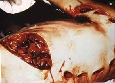shark_attack_pictures_002.jpg